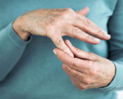 Which is the best medicine for arthritis?